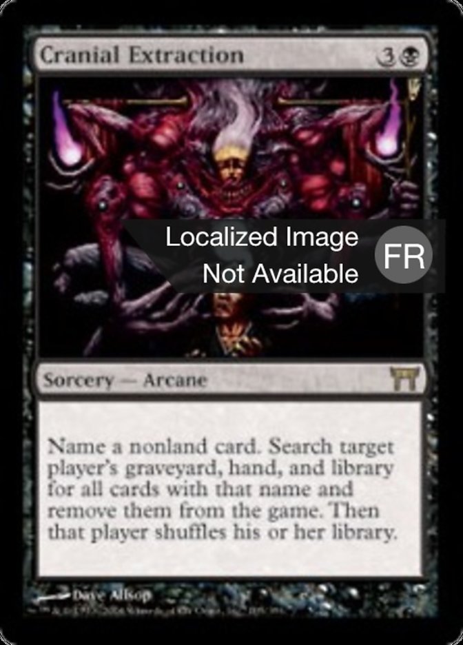 image Extraction crânienne