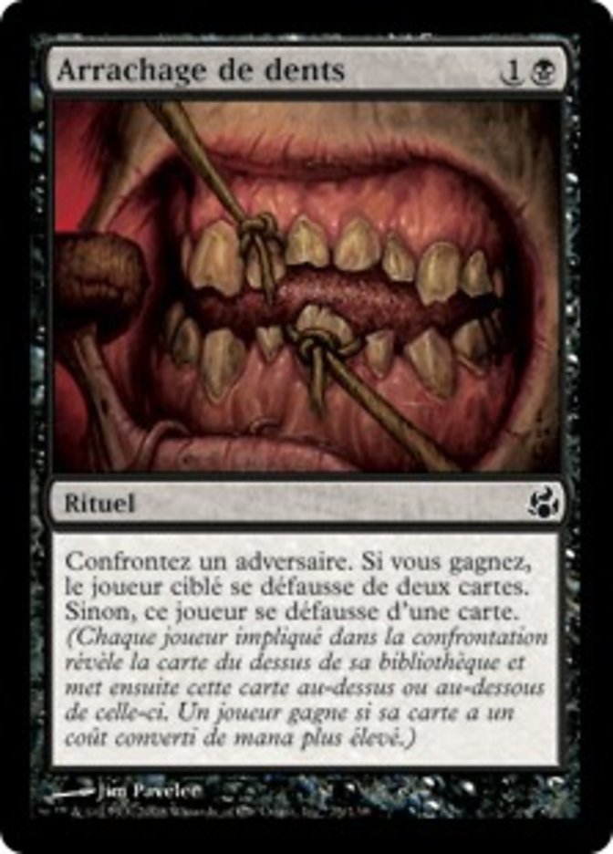 image Arrachage de dents